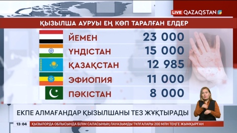 Қазақстан әлемдегі қызылша ауруы ең көп таралған 3 елдің қатарына кірді
