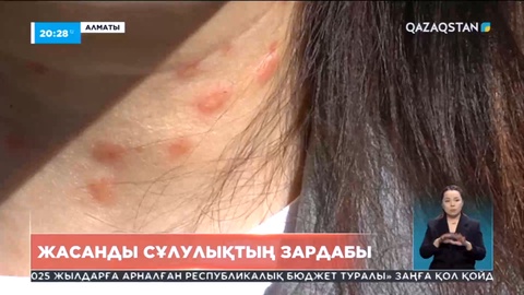 Алматылық тұрғынның косметологиялық ем-шарадан кейін денсаулығы нашарлап кетті
