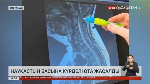 Қостанайда науқастың басына күрделі ота жасалды
