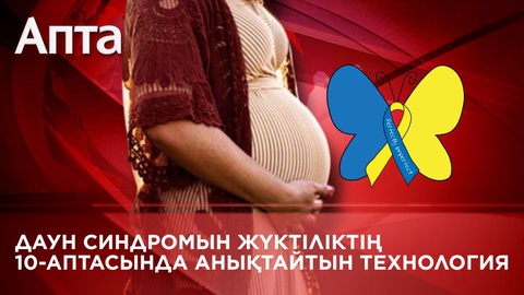 Елімізге Даун синдромын жүктіліктің 10-аптасында анықтайтын технология келді